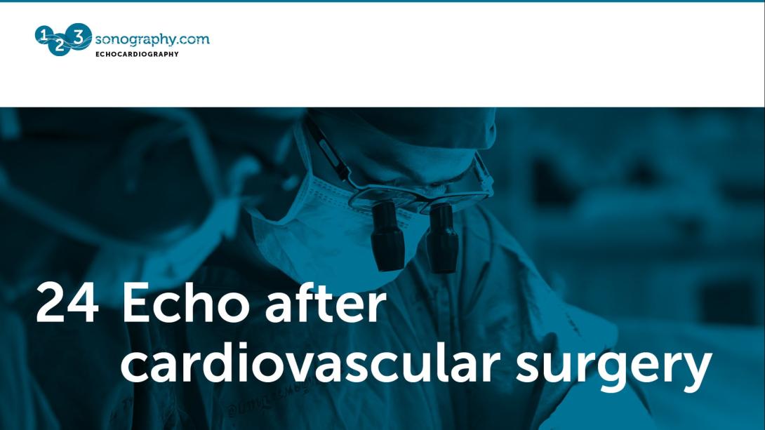 24 - Echo and  cardiovascular surgery