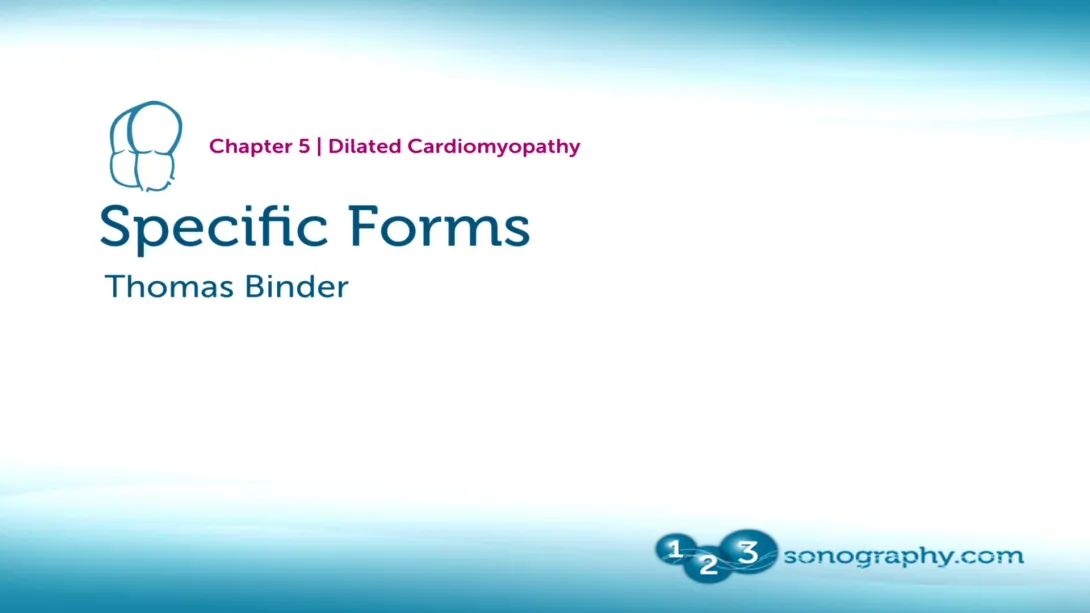 Dilated Cardiomyopathy Part 3