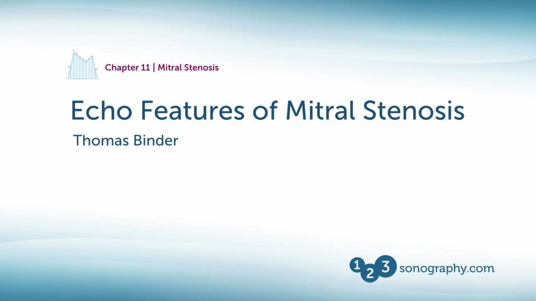 Mitral Stenosis - Features