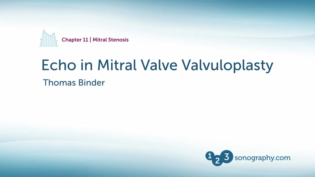 Mitral Stenosis - Valvuloplasty