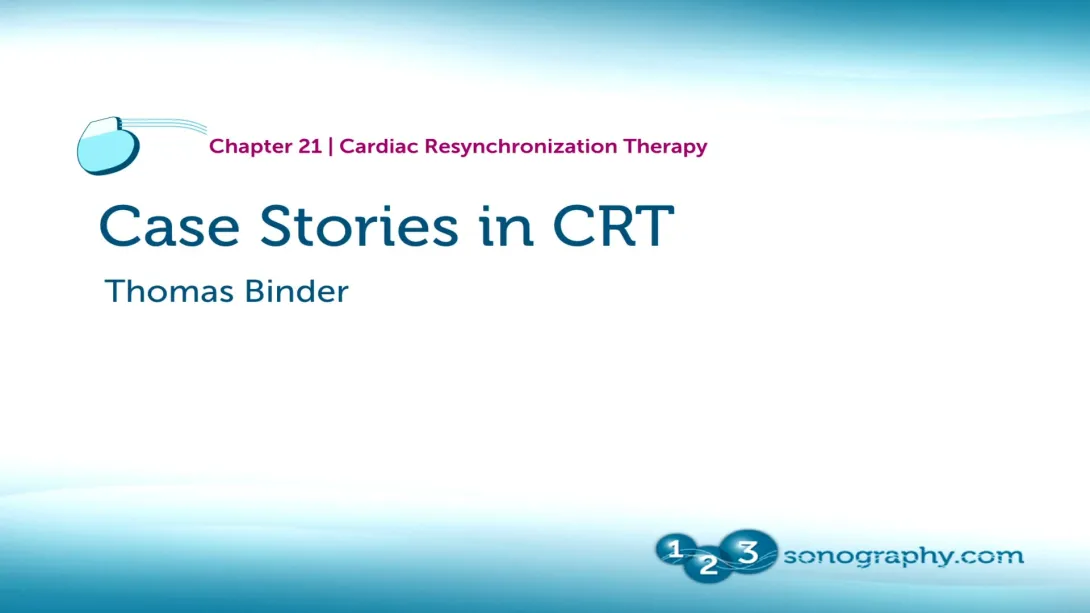 CRT Part 3