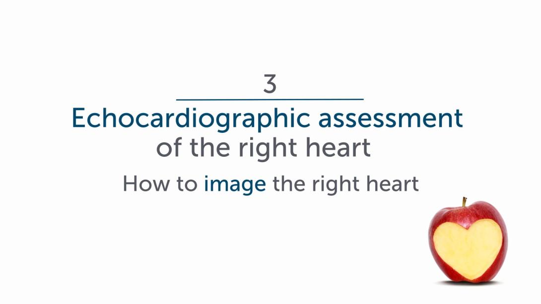 Echocardiographic Assessment - How to Image the Right Heart