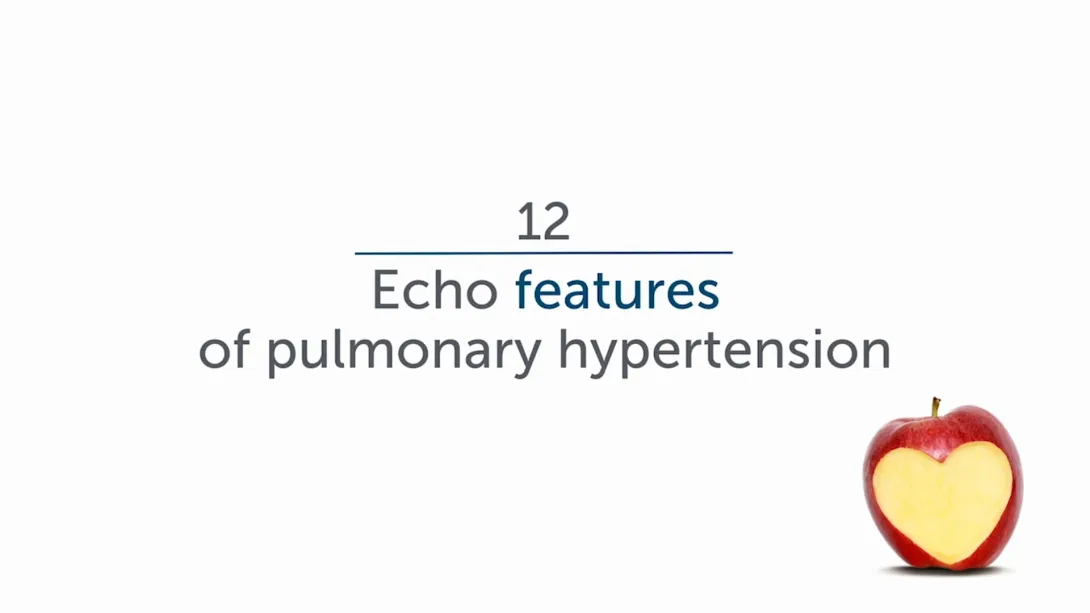 Pulmonary Hypertension - Diagnosis: Echo Features of PHT
