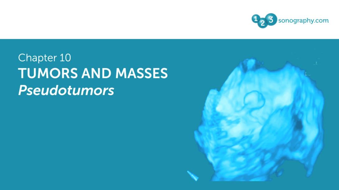 Tumors and Masses - Pseudotumors