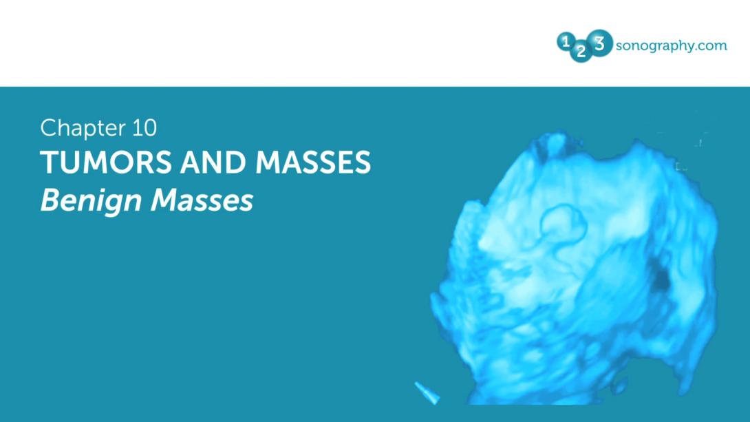 Tumors and Masses - Benign Masses