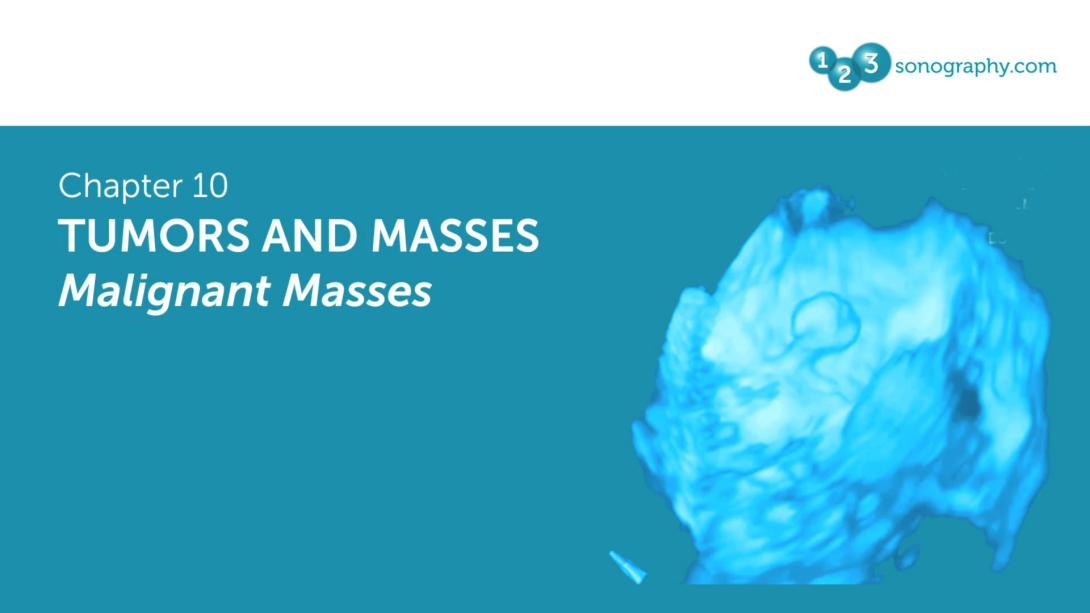 Tumors and Masses - Malignant Masses