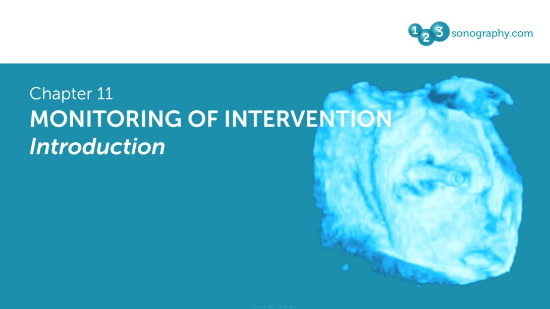 Monitoring of Intervention - Introduction