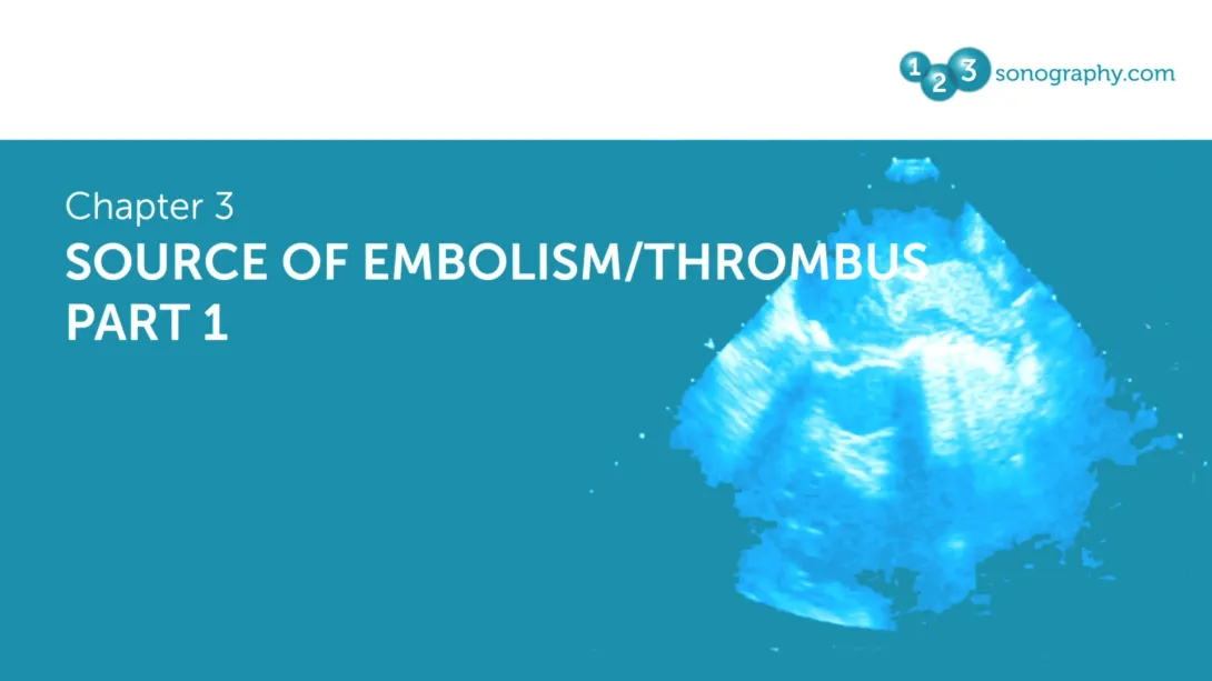 Source of Embolism / Thrombus Part 1