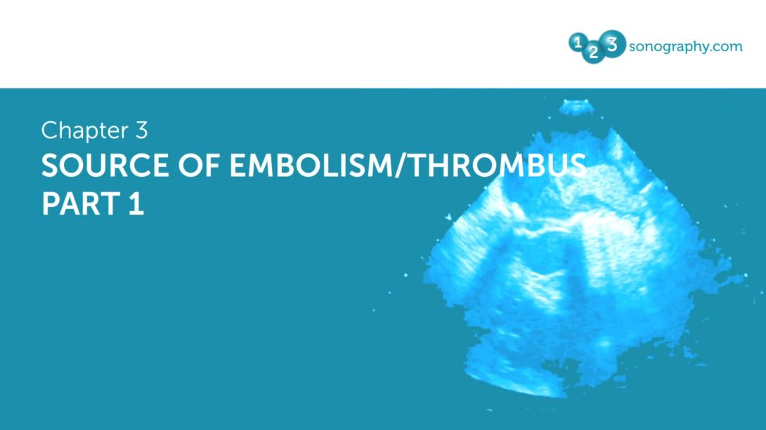 Source of Embolism / Thrombus Part 1