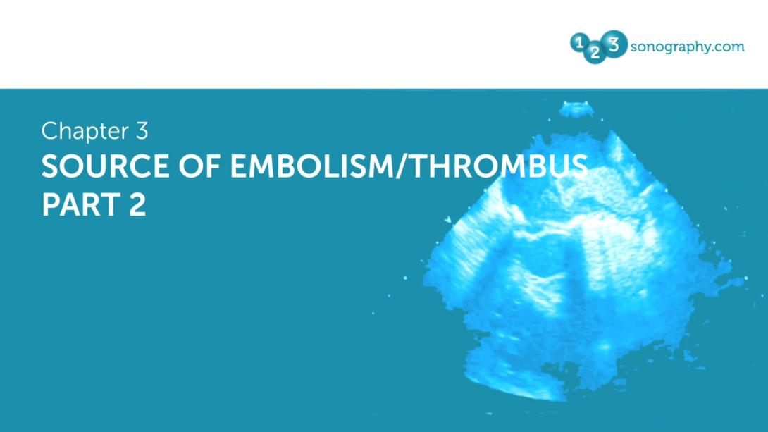 Source of Embolism / Thrombus Part 2