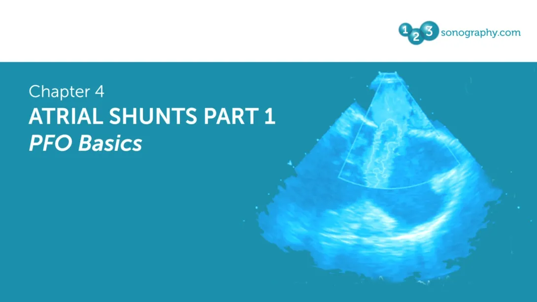 Atrial Shunts Part 1 - PFO Basics