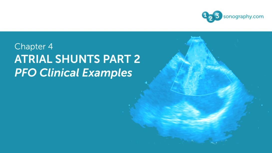 Atrial Shunts Part 2 - PFO Clinical Examples