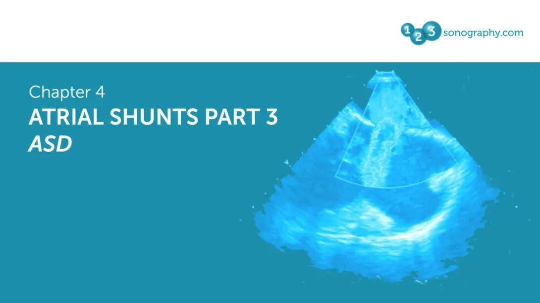 Atrial Shunts Part 3 - ASD