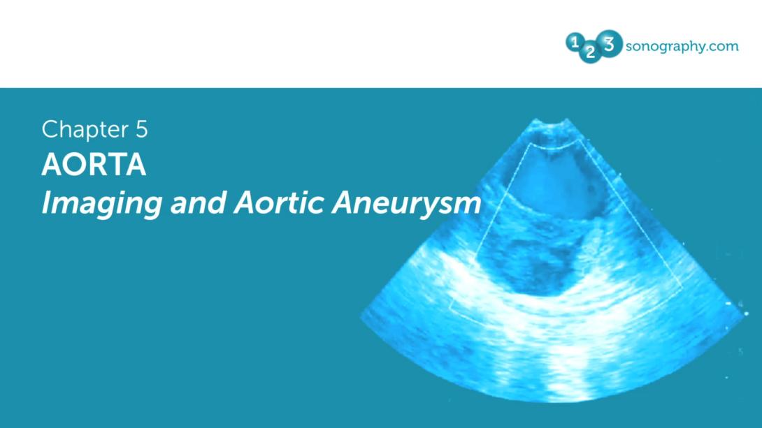 Aorta - Imaging and Aortic Aneurysm