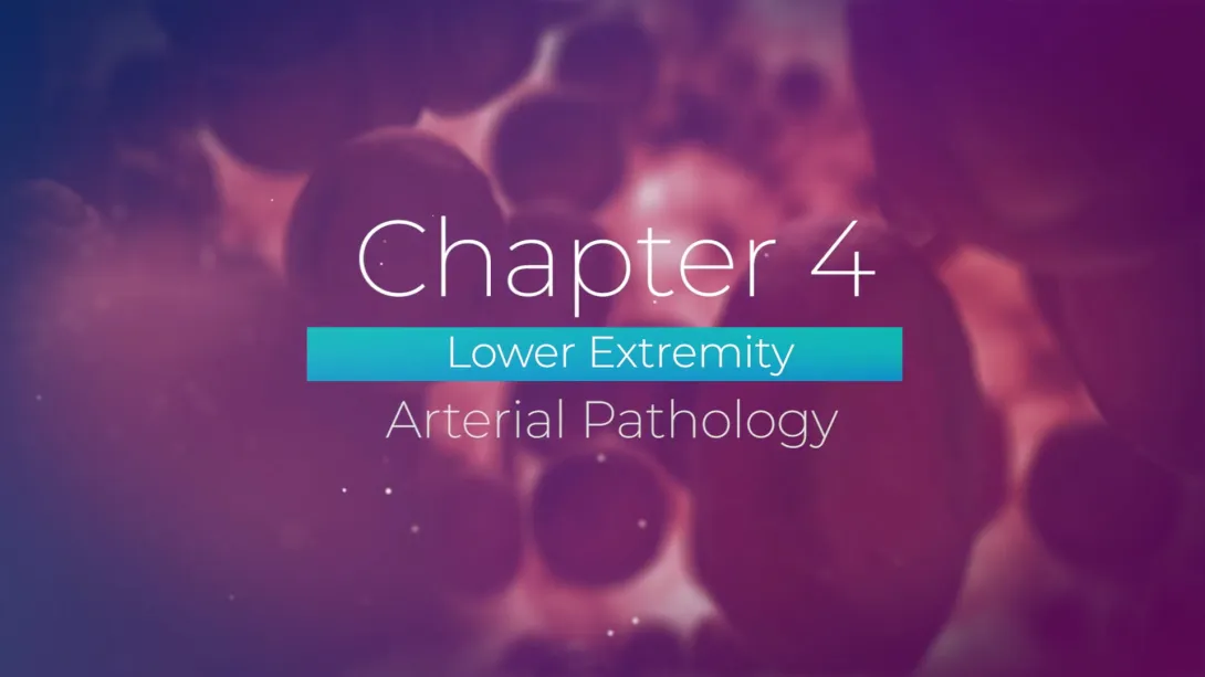 Atherosclerosis