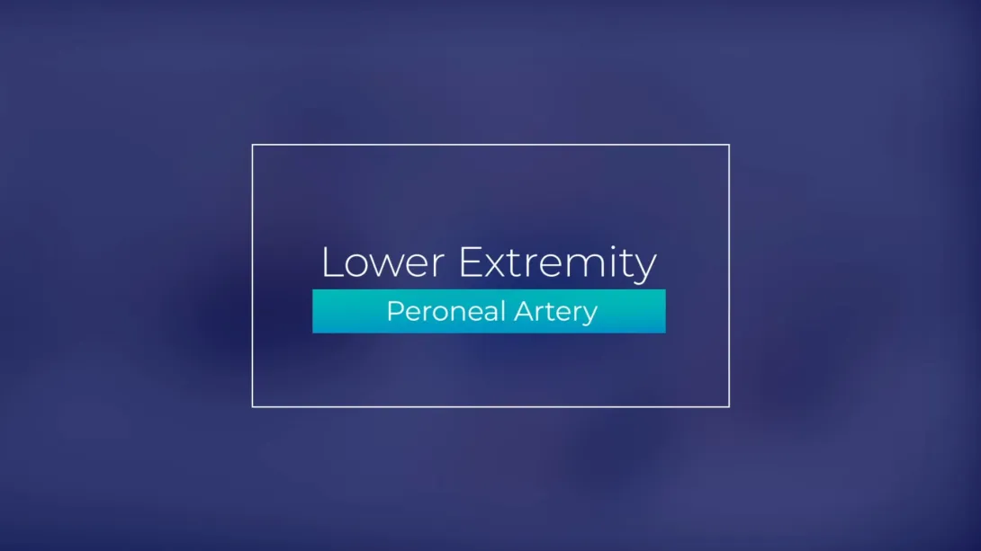 Peroneal Artery
