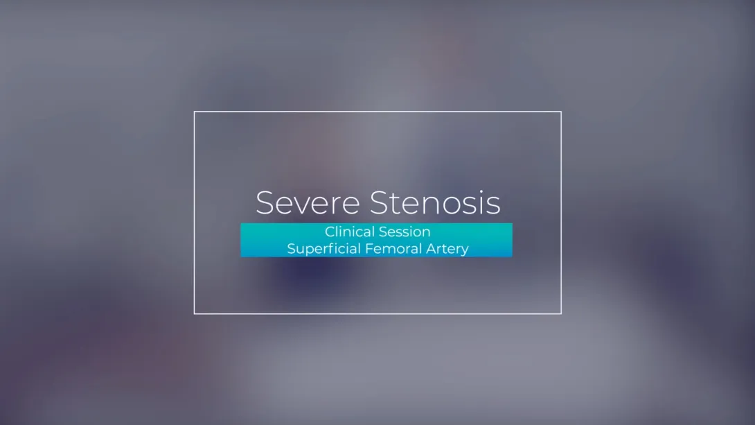 Clinical Session: Above Knee Level