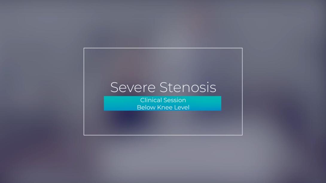 Clinical Session: Below Knee Level