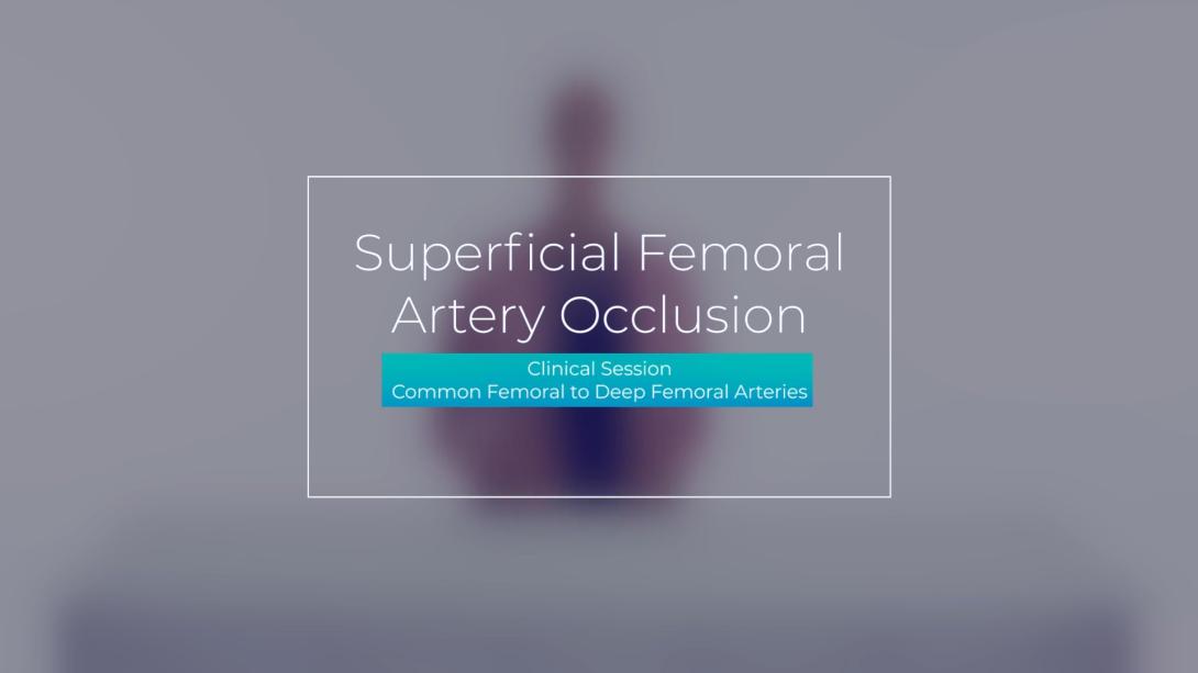 Clinical Session: Common Femoral to Deep Femoral Arteries