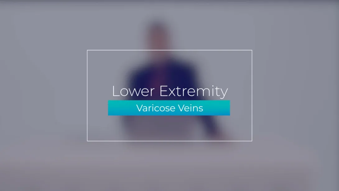 Varicose Veins
