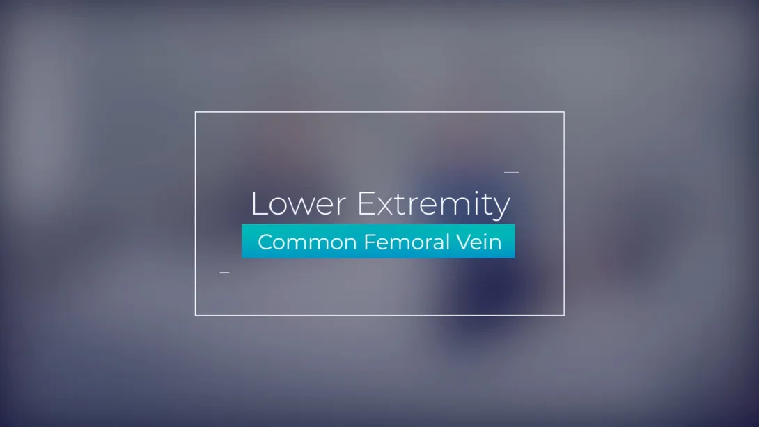 Common Femoral Vein