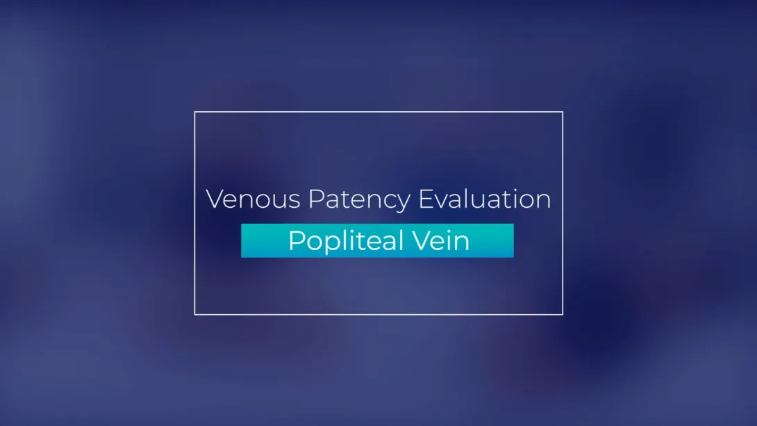 Popliteal Vein