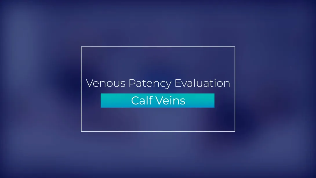 Calf Veins
