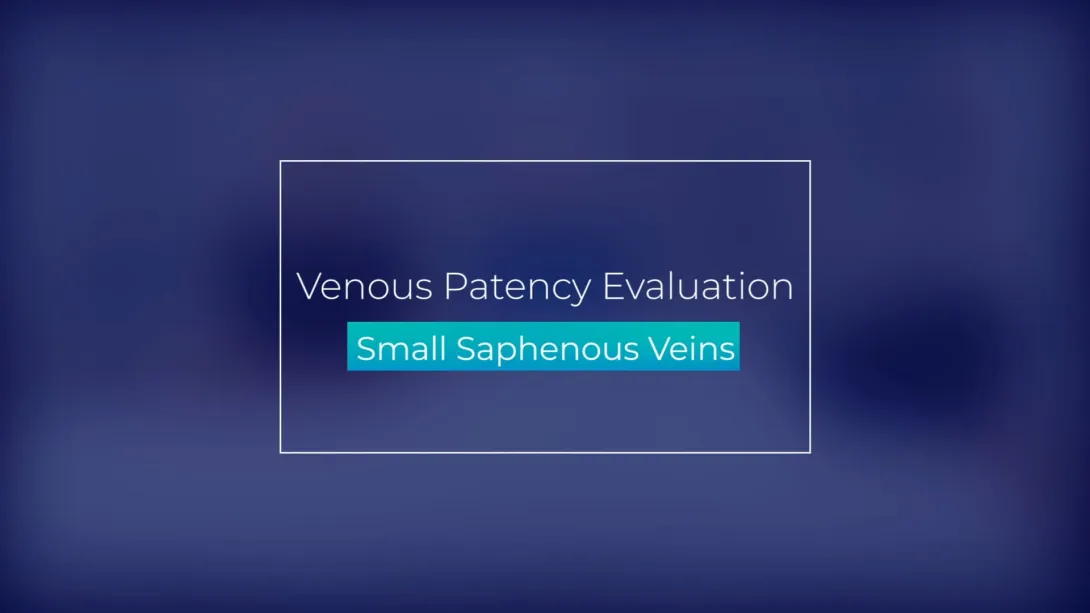 Small Saphenous Veins