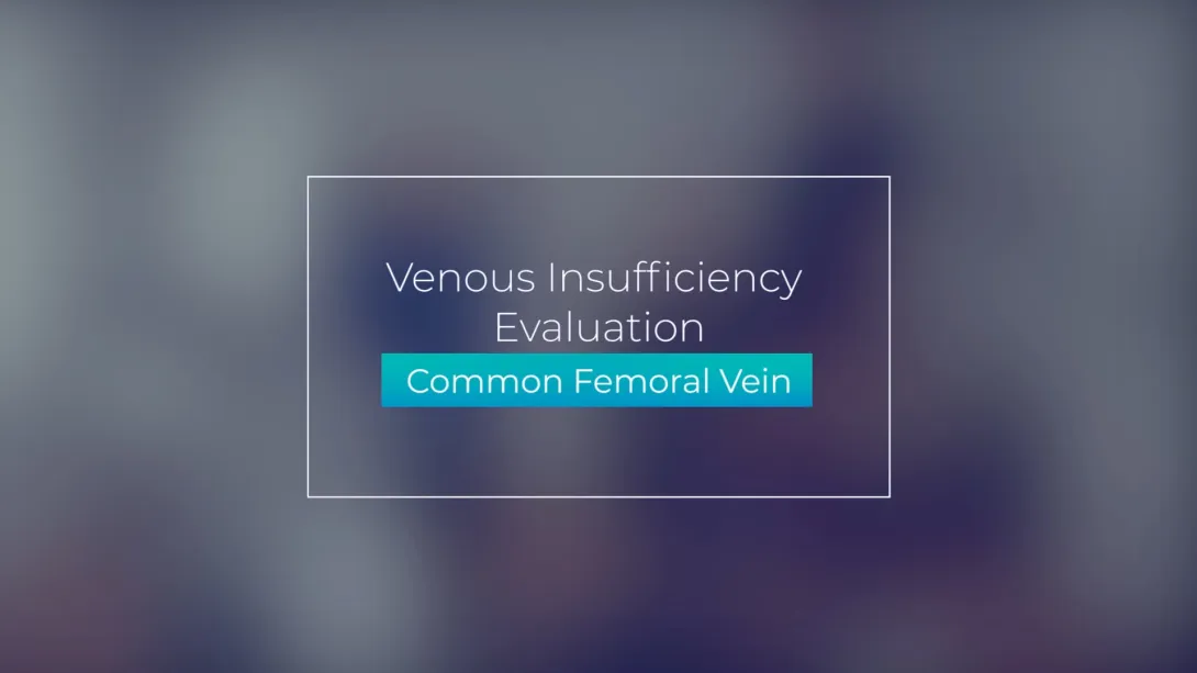 Common Femoral Vein