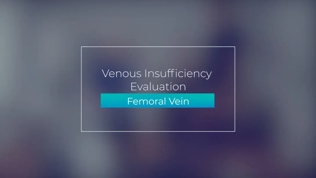 Femoral Vein