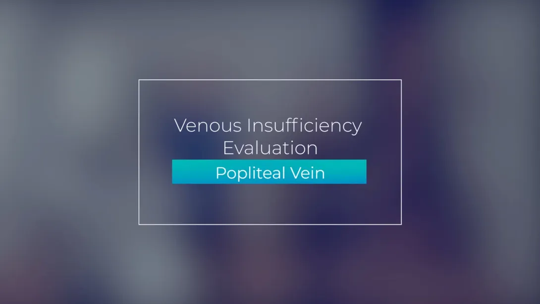 Popliteal Vein