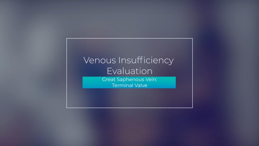 Great Saphenous Vein: Terminal Valve