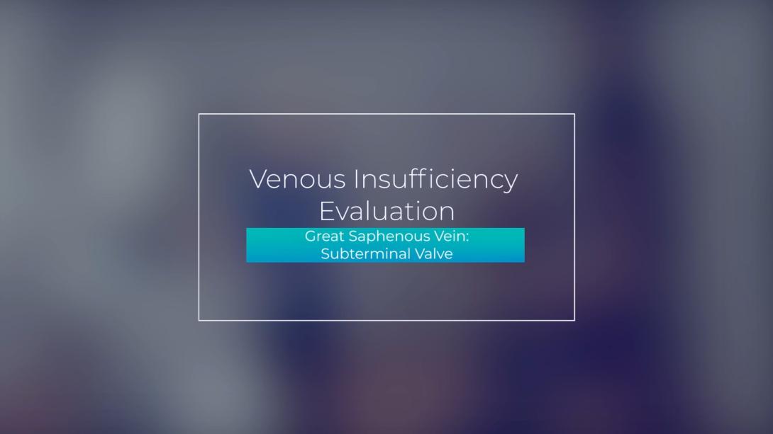Great Saphenous Vein: Subterminal Valve