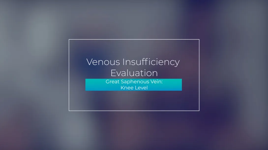 Great Saphenous Vein: Knee Level