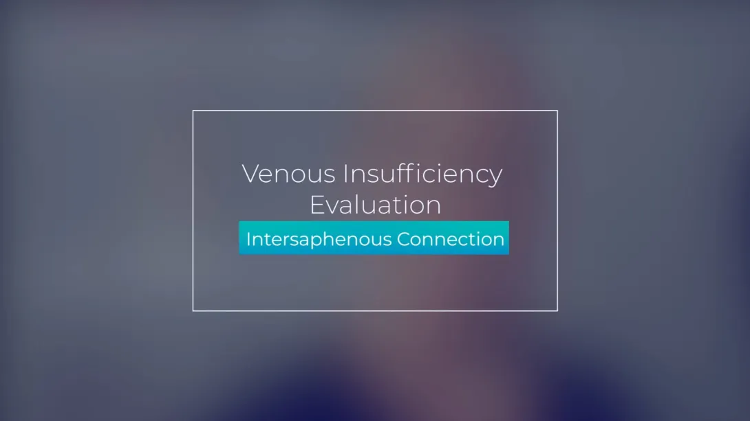 Intersaphenous Connection