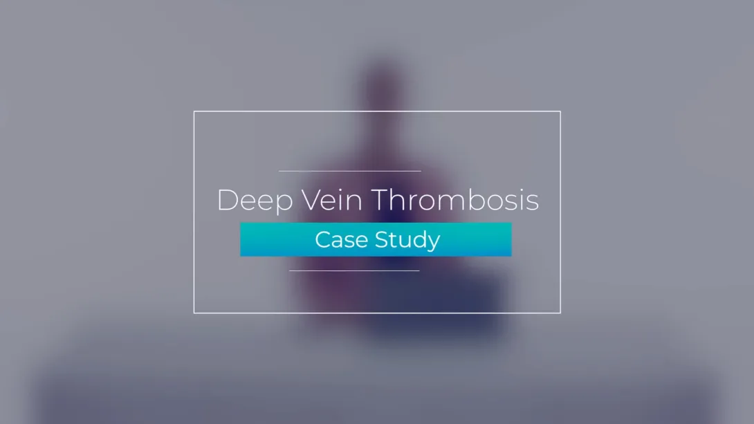 Case Study