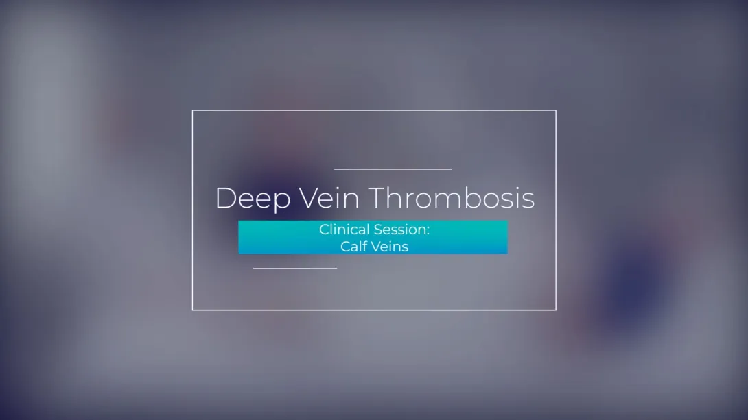 Clinical Session: Calf Veins