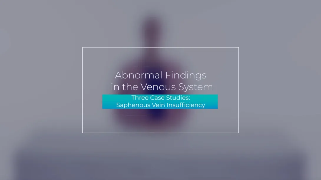 Three Case Studies: Saphenous Vein Insufficiency