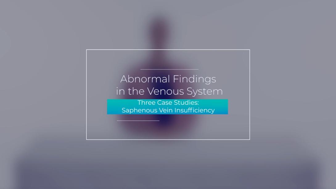 Three Case Studies: Saphenous Vein Insufficiency