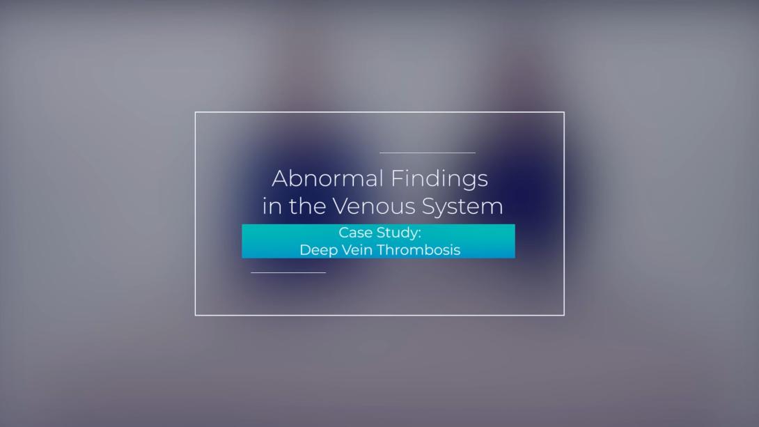 Case Study: Deep Vein Thrombosis