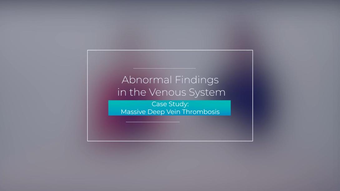 Case Study: Massive Deep Vein Thrombosis
