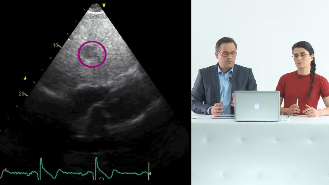 Beyond the diaphragm and other case examples