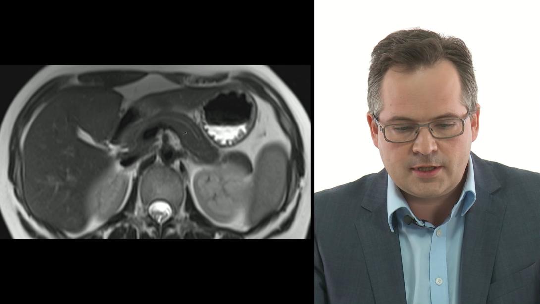 Pancreas: Anatomy and how to image