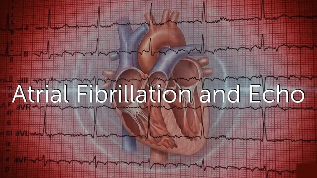 What Is the Role of Echocardiography in Atrial Fibrillation (AF)?