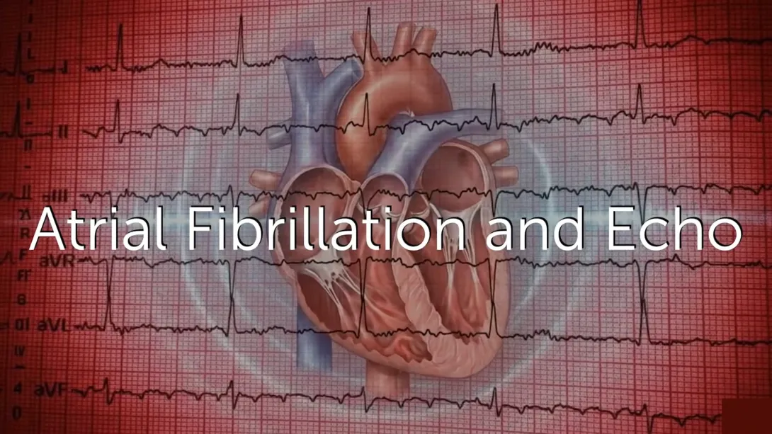 How Does Atrial fibrillation Affect Echo Assessment? 