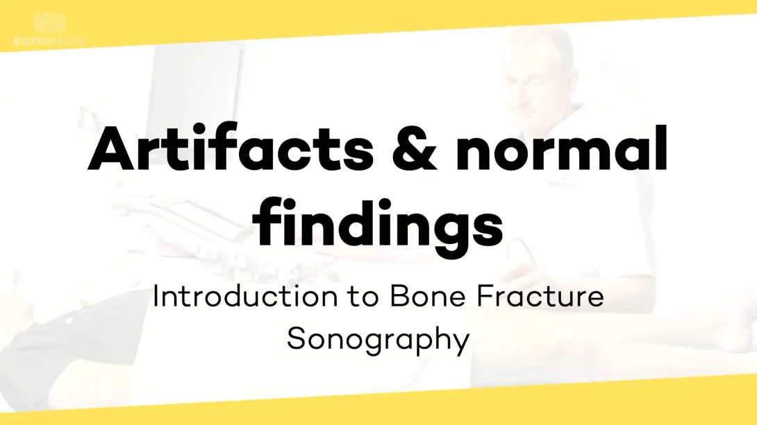 Artifacts and normal findings