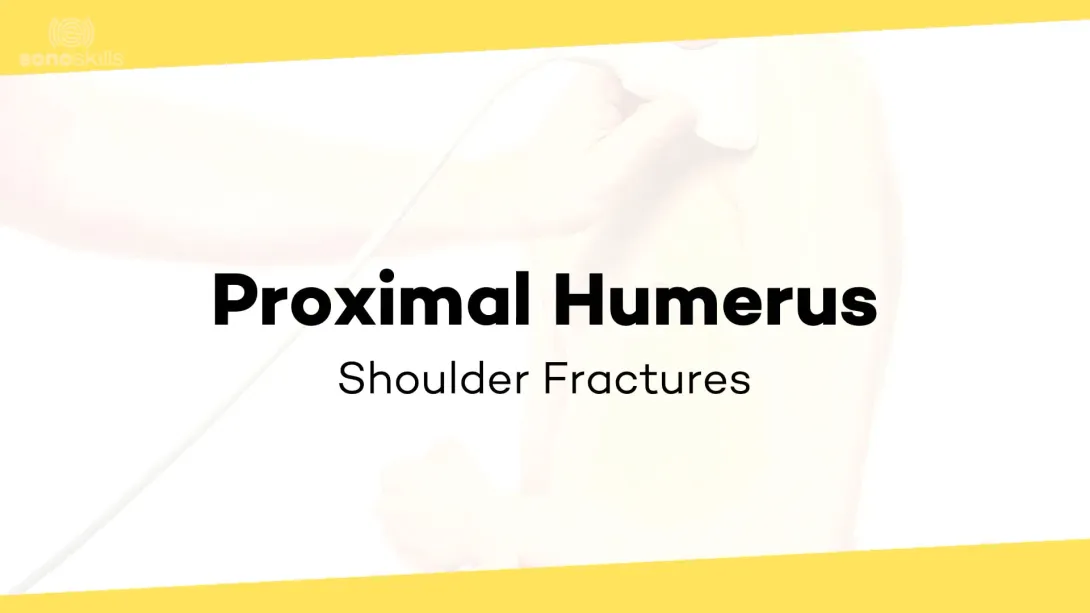 Fracture signs of proximal humerus