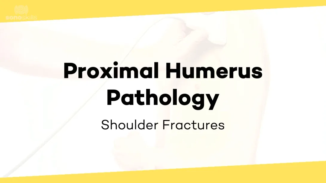 Pathology cases of proximal humerus fractures