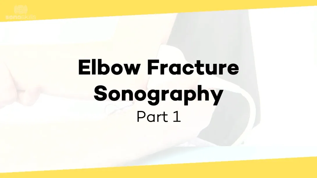 Elbow fractures - part 1