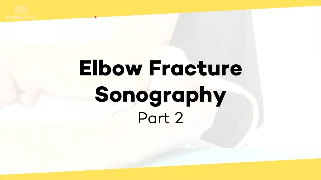 Elbow fractures - part 2